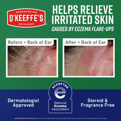 O’Keeffe’s Skin Repair Eczema Relief Body Cream, 48 Hour Moisture, 2% Colloidal Oatmeal, Unscented, 7oz Tube