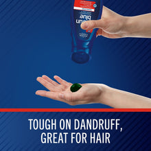 Selsun Blue medicated antidandruff shampoo bottle held by hand, 11 fl oz