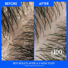 Before-and-after close-up scalp with reduced visible flakes