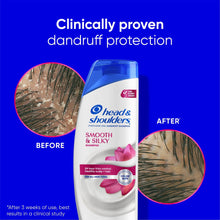 Head & Shoulders Smooth & Silky shampoo with scalp before-and-after circles