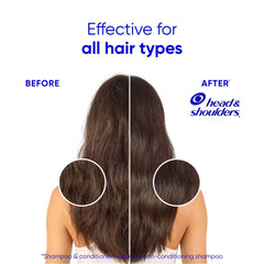 Head and Shoulders Dandruff Shampoo and Conditioner Set, Smooth and Silky, Frizz Control (3 PACK )