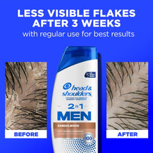 Head & Shoulders Men sandalwood dandruff shampoo bottle with before-and-after scalp closeups