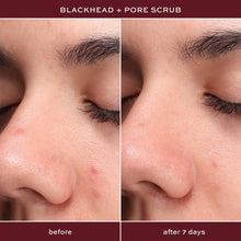 Skin close-up before and after ITK Blackhead + Pore Scrub exfoliation