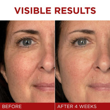 Face moisturizer results: woman's face before and after 4 weeks