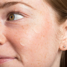 Round pimple patches on cheek and under-eye, skin-toned circles on face