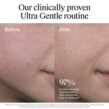 Facial skin care panel showing Ultra Gentle moisturizer applied, before and after.