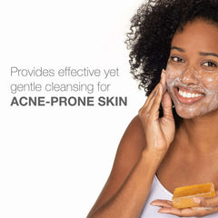 Neutrogena Acne Face Wash Bar, Acne Treatment for Acne-Prone Skin, Facial Cleanser, 3.5 oz