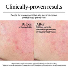 Before-and-after skin smoothness comparison showing reduced redness
