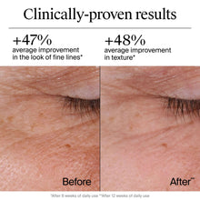 Neutrogena retinol cream skin results before-and-after panel