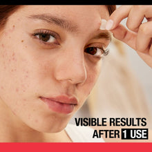Acne skin care results on face, fingers near forehead.