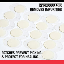 Hydrocolloid acne patches, oval patches on white backing sheet.