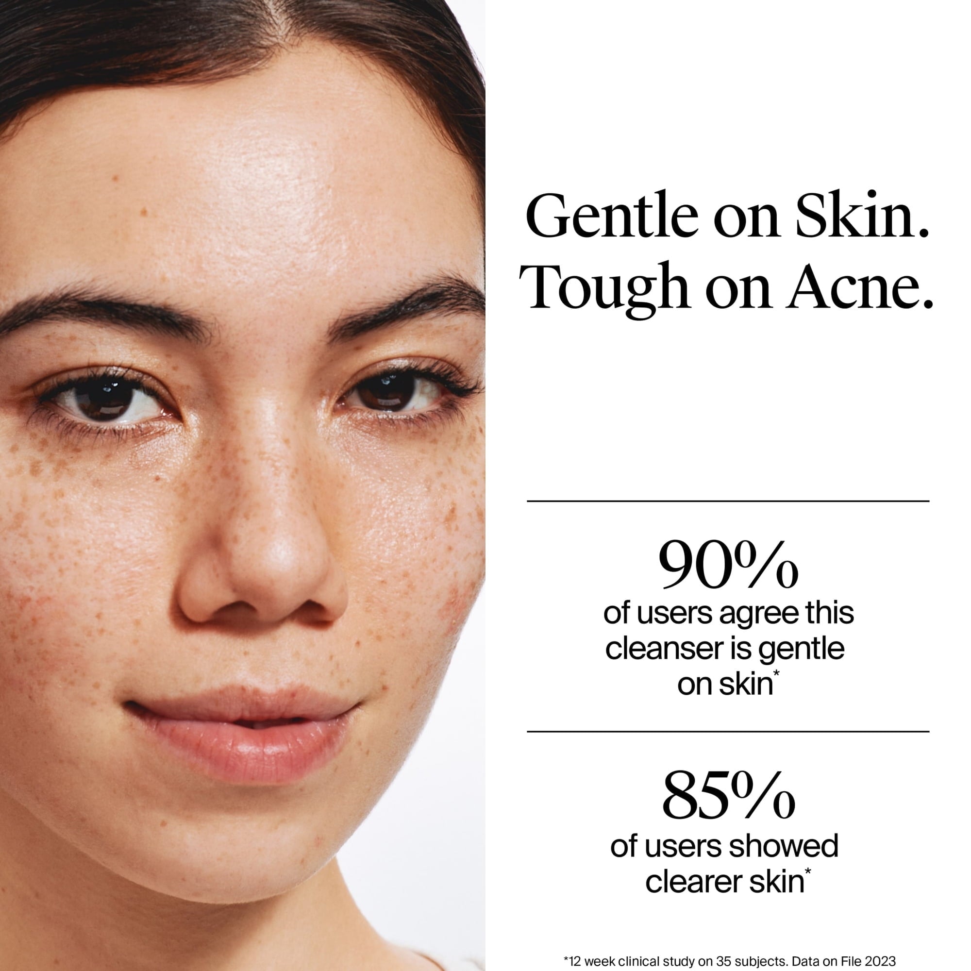Neutrogena Oil-Free Acne Face Wash, Salicylic Acid Facial Cleanser & Acne Treatment, 9.1 fl oz  ( 2 PACK )