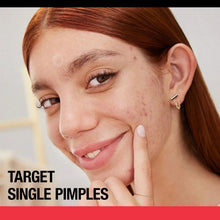 Clear acne blemish patch on cheek of smiling woman, single spot application