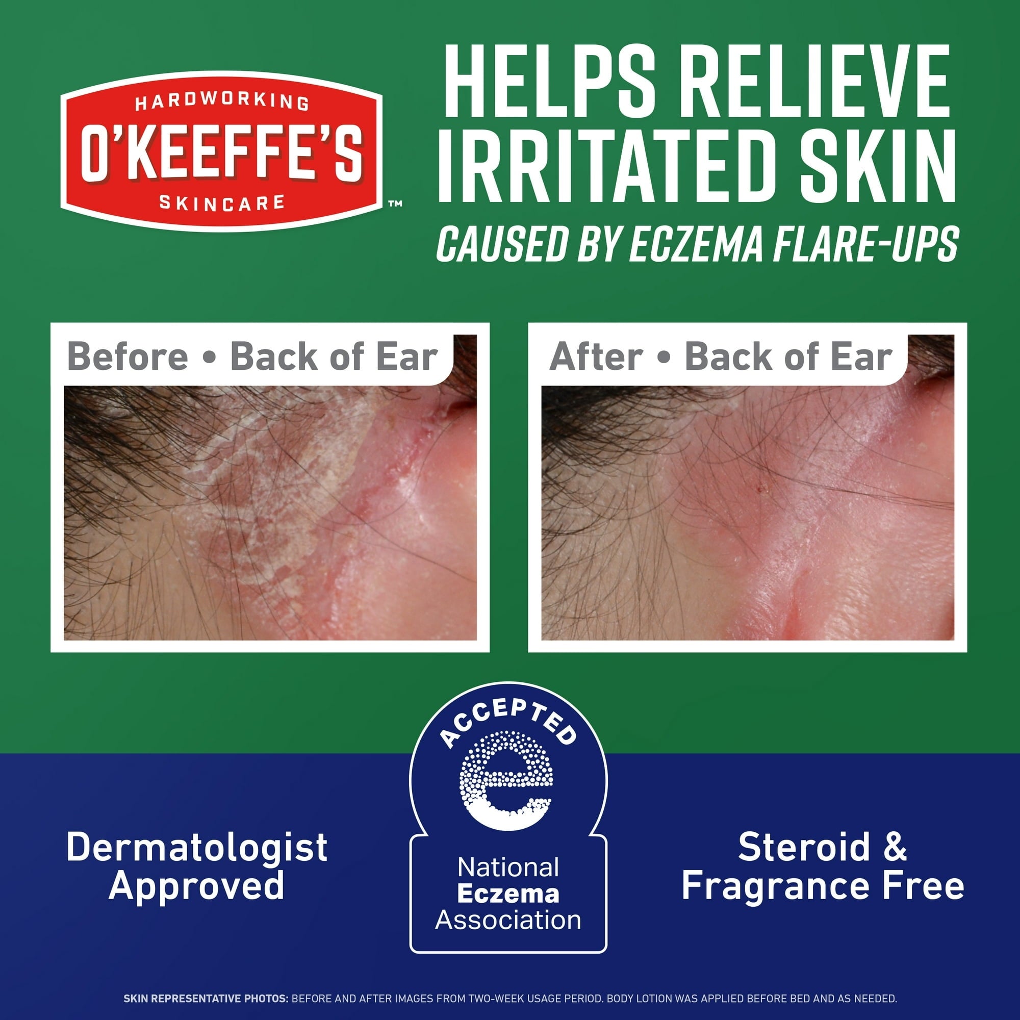 O’Keeffe’s Skin Repair Eczema Relief Body Cream, 48 Hour Moisture, 2% Colloidal Oatmeal, Unscented, 7oz Tube
