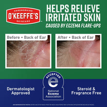Eczema relief body cream before-and-after back-of-ear results chart