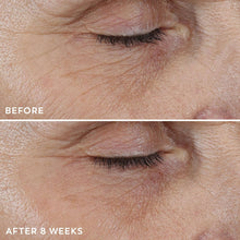 Close-up skin texture before and after 8 weeks of treatment