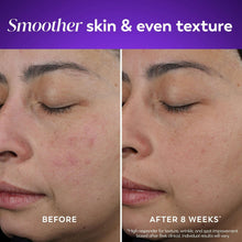 Facial skin before-and-after comparison showing smoother texture with retinol cream.