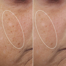 Skin close-up before-and-after comparison with outlined area
