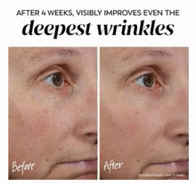 Facial moisturizer before-and-after close-up around eyes