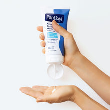 Acne wash tube dispensing cream onto a hand, with white pump cap