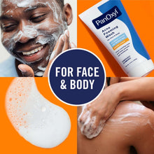 Acne foaming wash foam lather on skin and hands with squeeze tube