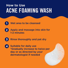 Acne foaming wash application graphic with foam dollop and tube