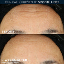 Forehead skin before and after retinol treatment with reduced line appearance