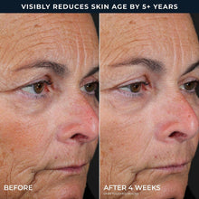 RoC Line Smoothing 2-Step Retinol Peel Pads, 36 ct.