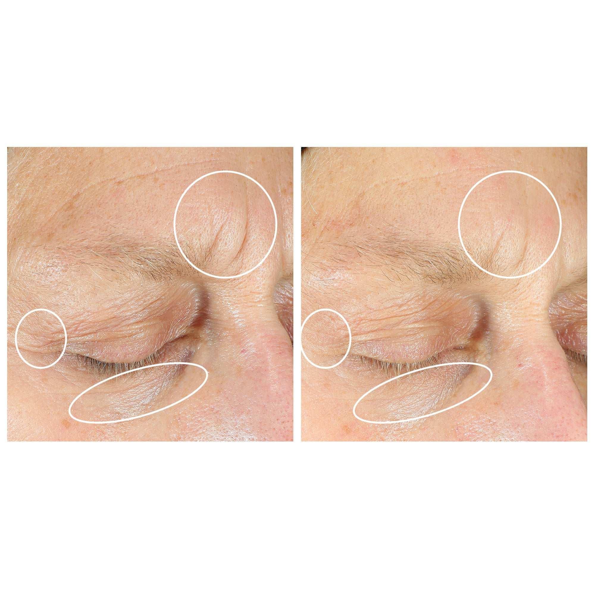 StriVectin Anti-Wrinkle Intensive Eye Concentrate Plus