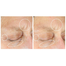 Under-eye skin care results comparison with circled areas near eye