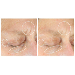 StriVectin Anti-Wrinkle Intensive Eye Concentrate Plus