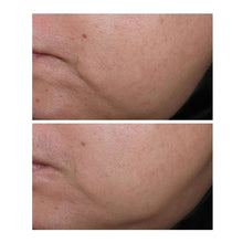 Cheek skin close-up showing two side-by-side results