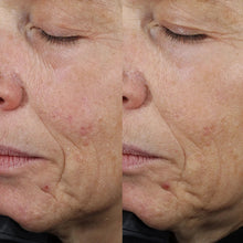 Peptide plump collagen cushion cream on face skin, before-and-after split view