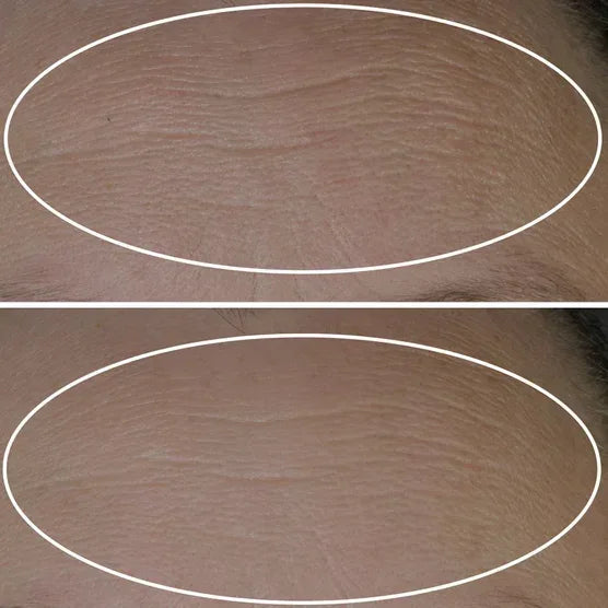 StriVectin Peptide Plump Line Filling Bounce Serum, 1.0 fl oz + 0.5 fl oz