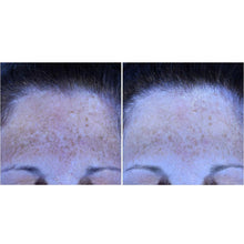 Facial skin close-up with light speckling on forehead area