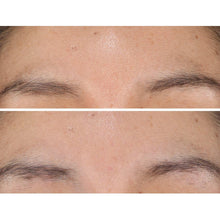 Close-up of forehead skin texture with an even, smooth appearance