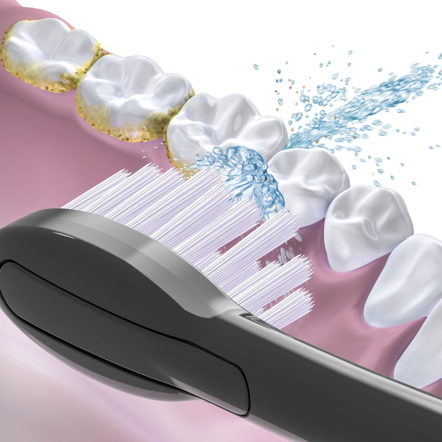 Waterpik Sonic-Fusion Full-Size Replacement Flossing Toothbrush Heads, Choose Color, 6 pk.